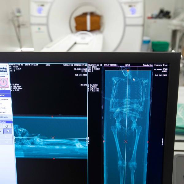 2022-11-28 - Estudio forense del cuerpo de san Isidro