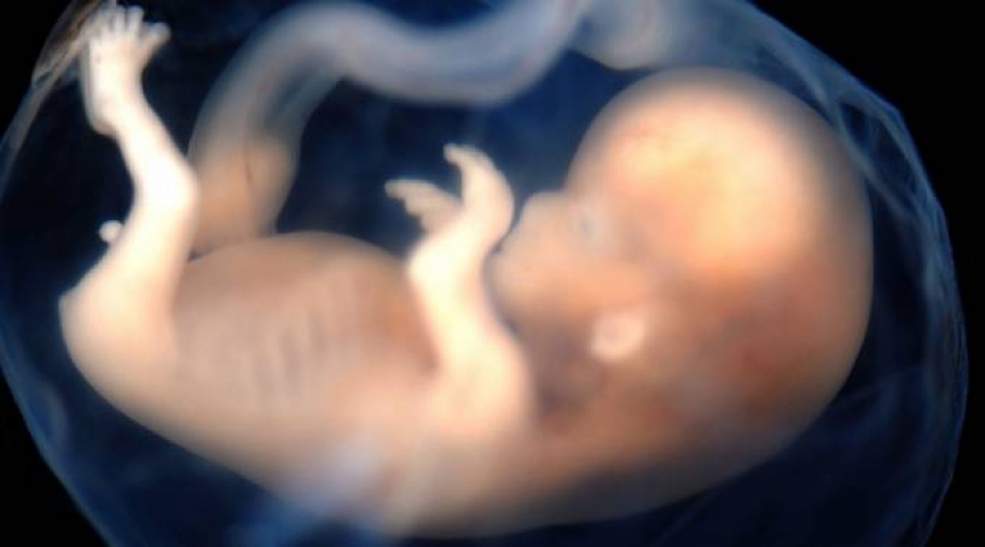 Imponer el aborto como «un valor» ofende a muchos, afirma obispo