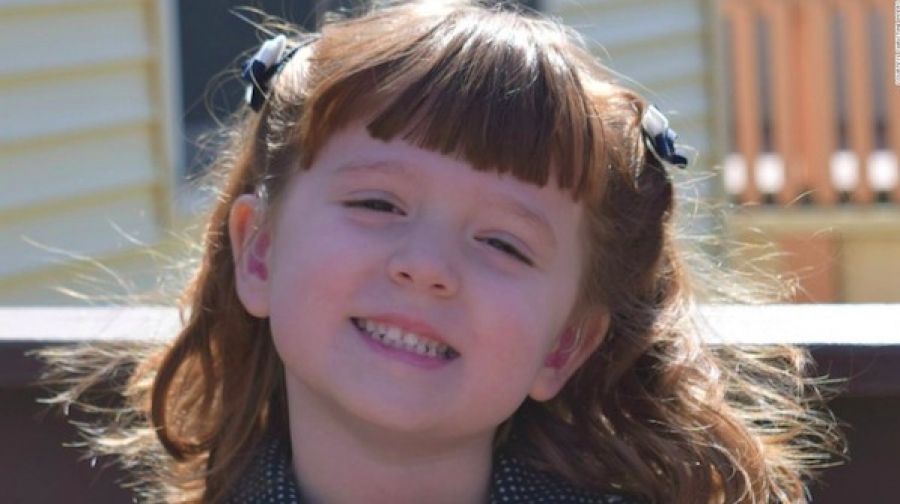 La pequeña Lizzy Myers saludará al Papa antes de quedarse ciega