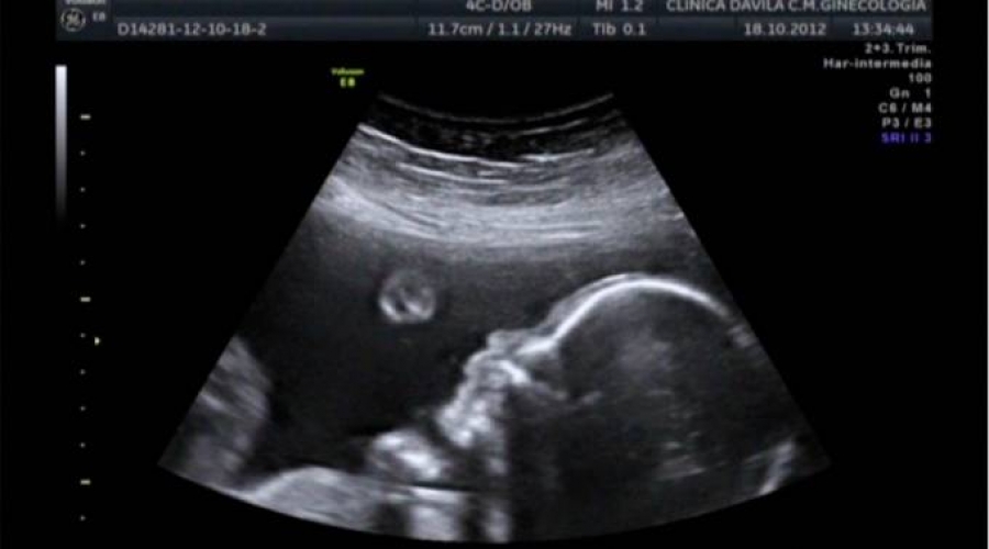 Estudio demuestra que los bebés en el vientre pueden reconocer rostros humanos