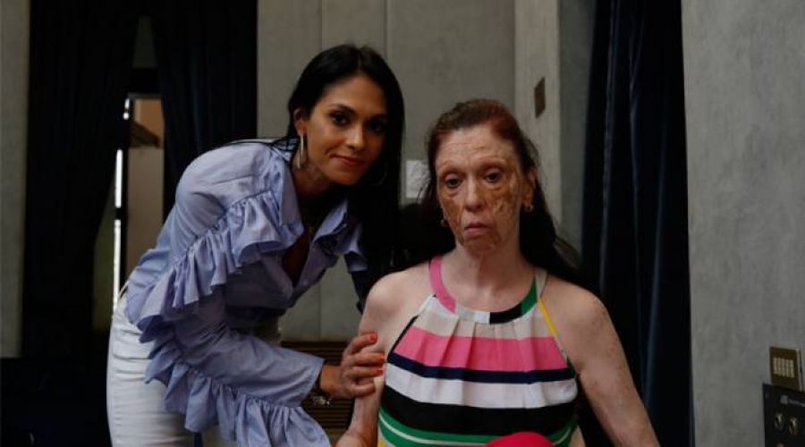 Sabe que sufrirá enfermedad degenerativa, pero su fe le ayuda a levantarse cada día